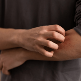 person-dealing-with-rosacea_23-2150478595 person-dealing-with-rosacea_23-2150478595